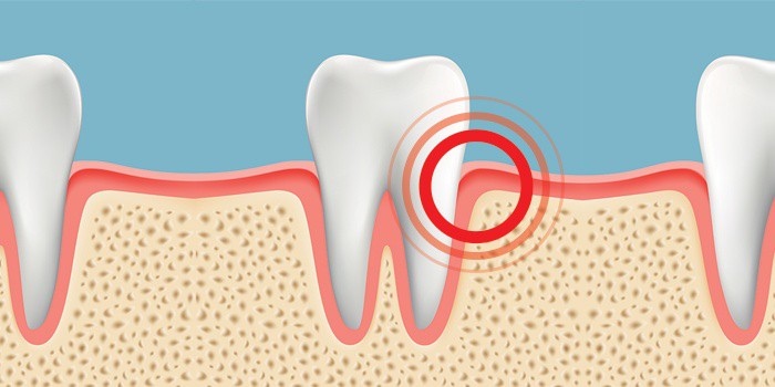 سلامت و درمان-دندان